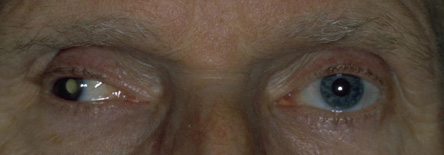 Werner Heumann Institut für künstliche Augen e.K.