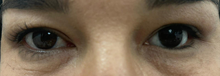 Werner Heumann Institut für künstliche Augen e.K.