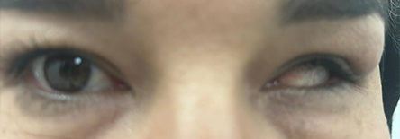 Werner Heumann Institut für künstliche Augen e.K.